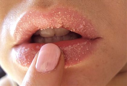 Напуканите устни: витамини и минерали, които ще ни помогнат